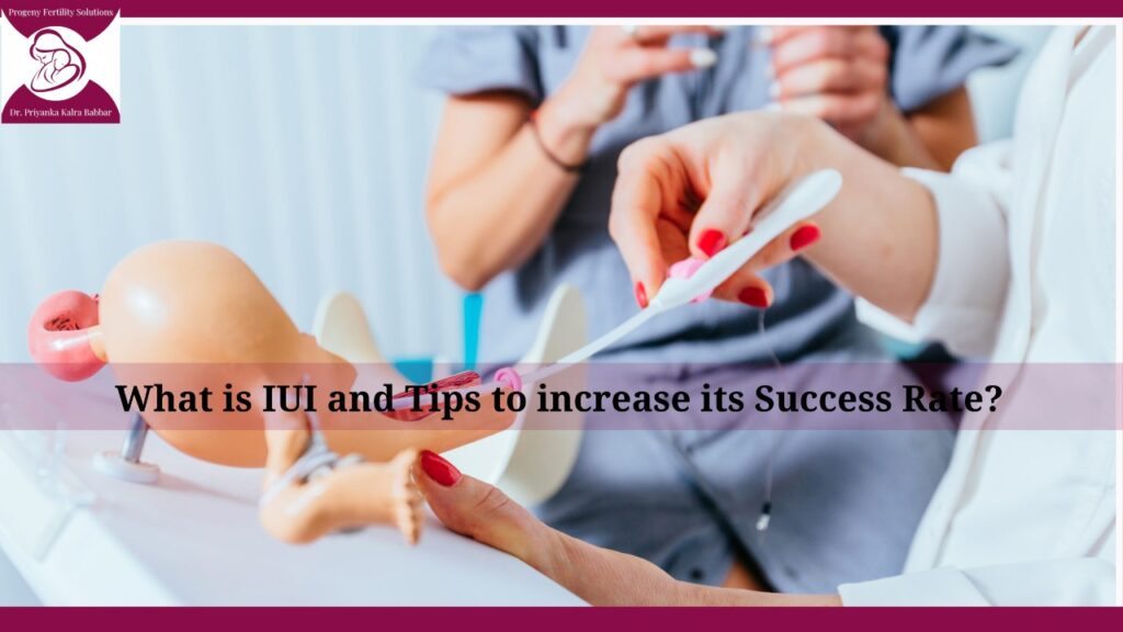 What is IUI and Tips to increase its Success Rate -Dr. Priyanka.jpeg